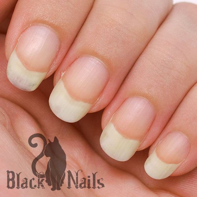How To Whiten Yellow Stained Nails Part 1 Black Cat Nails