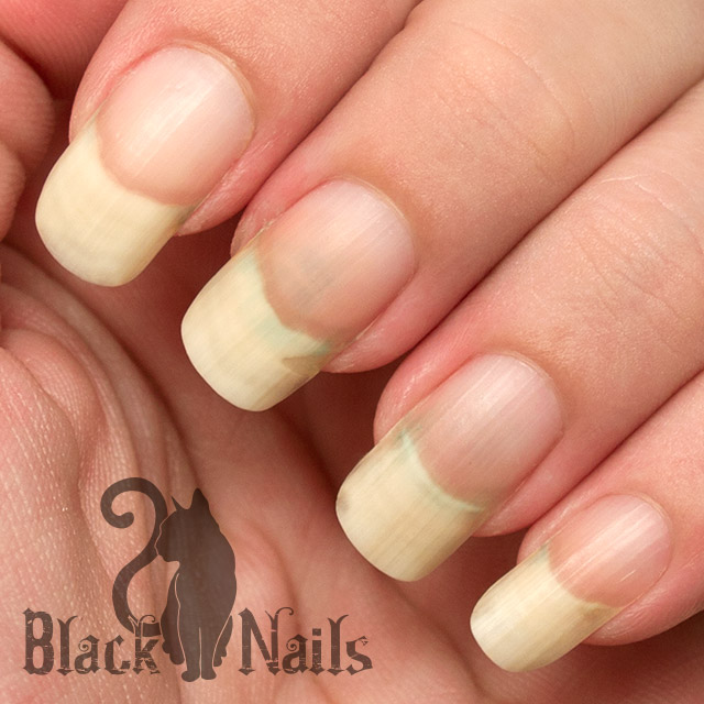 How To Whiten Yellow Stained Nails Part 1 Black Cat Whiten Nails Baking Soda Peroxide After